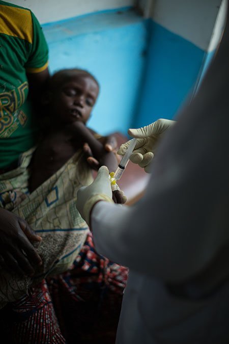2 year-old Issufu with his mother being treated for acute malnutrition