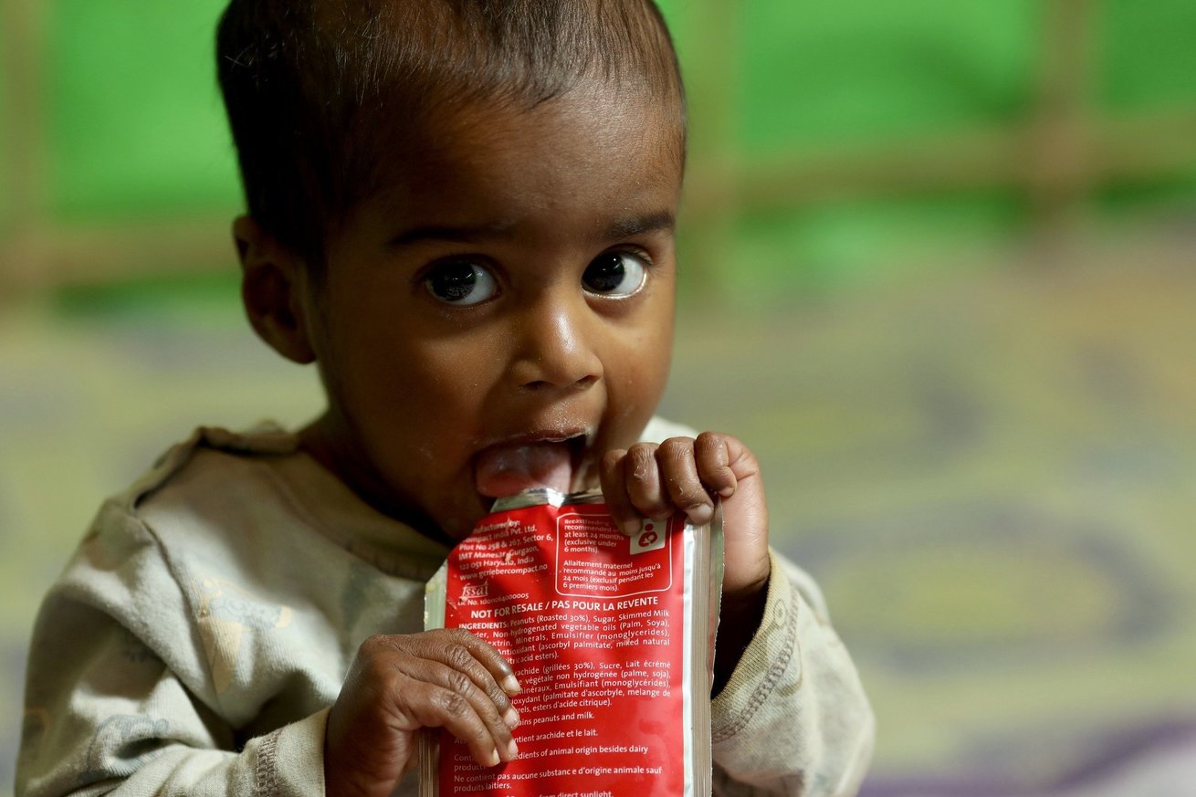 Yasmin eats Plumpy nut, a high-protein food to help malnourished children